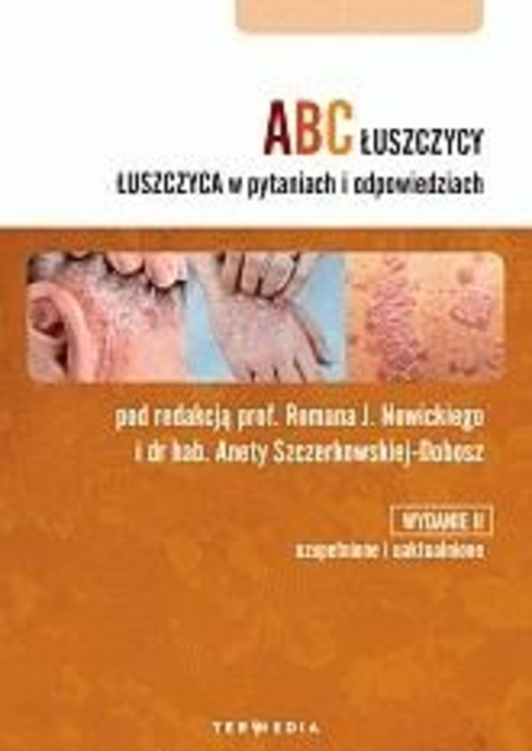 ABC łuszczycy. Łuszczyca w pytaniach i odpowiedziach