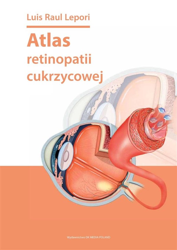 Atlas retinopatii cukrzycowej