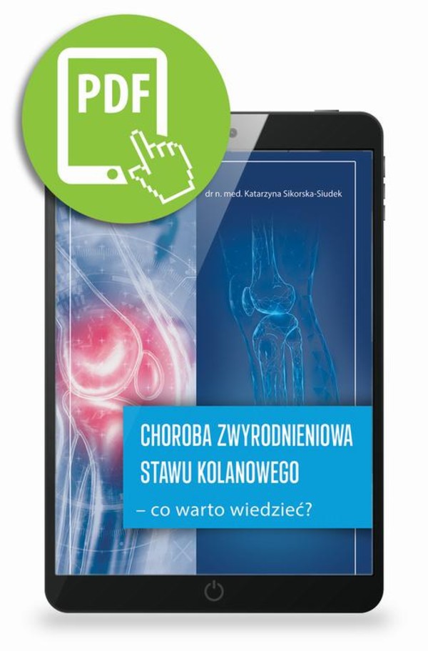 Choroba zwyrodnieniowa stawu kolanowego – co warto wiedzieć? - pdf