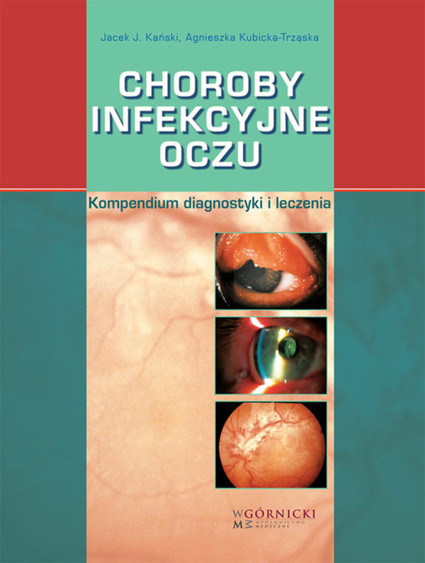 Choroby infekcyjne oczu Kompendium diagnostyki i leczenia