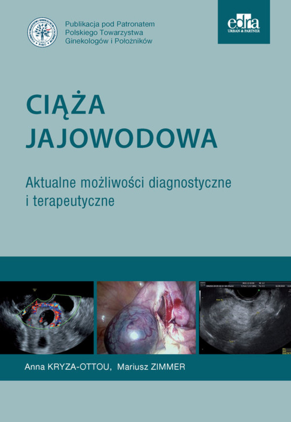 Ciąża jajowodowa Aktualne możliwości diagnostyczne i terapeutyczne