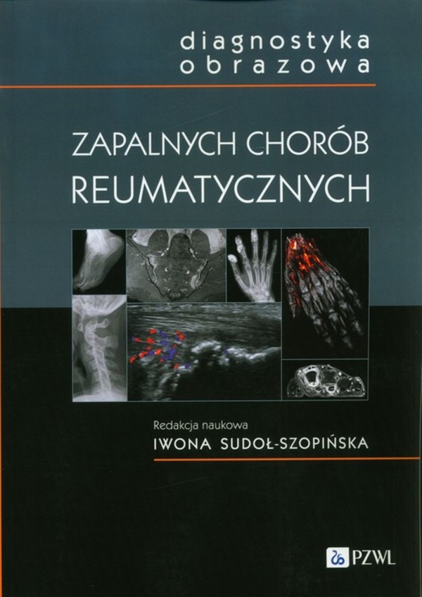 Diagnostyka obrazowa zapalnych chorób reumatycznych