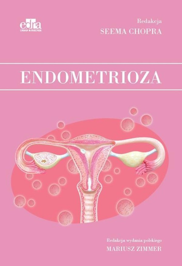 Endometrioza