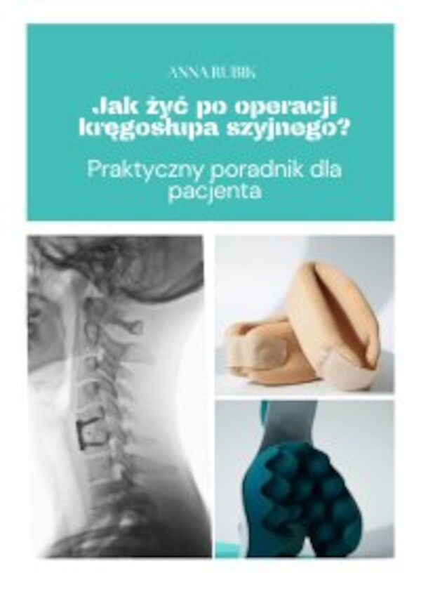 Jak żyć po operacji kręgosłupa szyjnego? Praktyczny poradnik dla pacjenta - mobi, epub, pdf