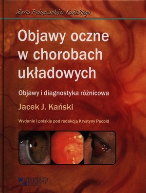 Objawy oczne w chorobach układowych Objawy i diagnostyka różnicowa