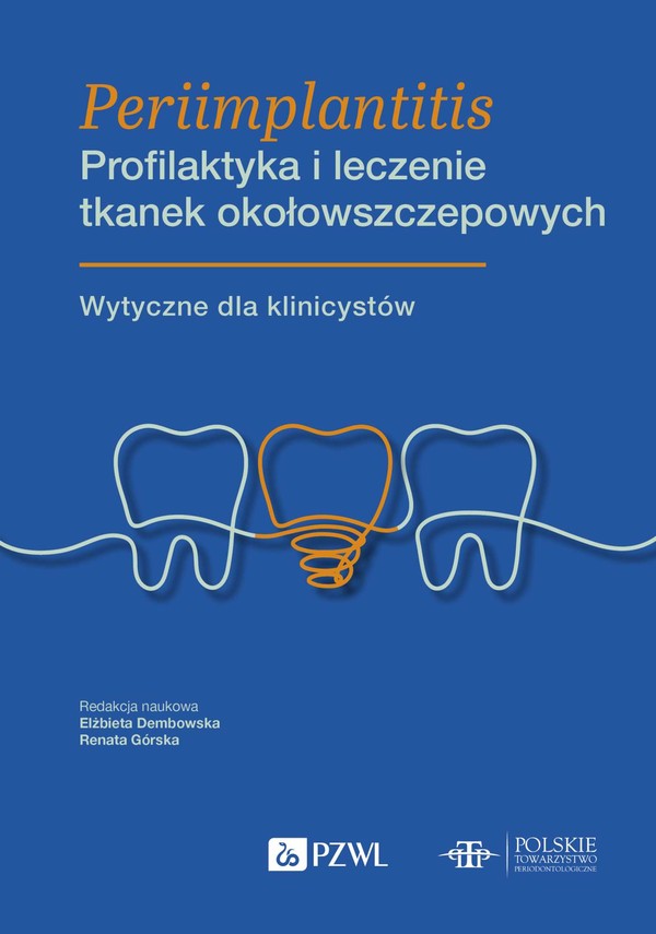 Periimplantitis Profilaktyka i leczenie tkanek okołowszczepowych