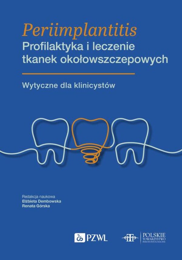 Periimplantitis Profilaktyka i leczenie tkanek okołowszczepowych - mobi, epub