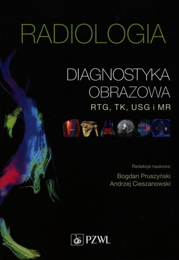 Radiologia Diagnostyka obrazowa Rtg TK USG i MR