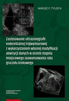 Zastosowanie ultrasonografii endorektalnej trójwymiarowej - pdf z wykorzystaniem własnej modyfikacji akwizycji danych w ocenie stopnia miejscowego zaawansowania raka gruczołu krokowego