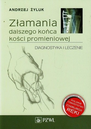 Złamania dalszego końca kości promieniowej Diagnostyka i leczenie