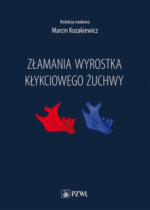 Złamania wyrostka kłykciowego żuchwy